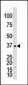 GALK1 Antibody (C-term)