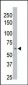 PPM1D Antibody (C-term)