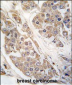 CTDSP2 Antibody (N-term)