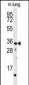 CTDSP2 Antibody (N-term)