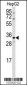 CTDSP2 Antibody (N-term)