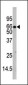 Phospho-IL1R(Y496) Antibody