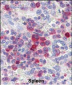 PIM3 Antibody (C-term)