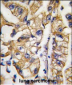 HDBP1 Antibody (Center)