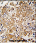 LECT1 Antibody (C-term)