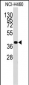 LECT1 Antibody (C-term)