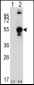 LECT1 Antibody (C-term)