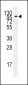 ADCY2 Antibody (C-term)