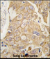 ADCY2 Antibody (C-term)