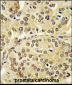 TIEG Antibody (N-term)