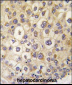 ARHE Antibody (Center)