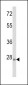 ARHE Antibody (Center)