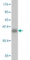 ADH4 Antibody (monoclonal) (M01)