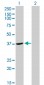 ADH4 Antibody (monoclonal) (M01)
