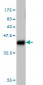 ALAS1 Antibody (monoclonal) (M01)