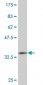 ALAS1 Antibody (monoclonal) (M03)