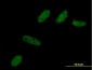 BCL2L12 Antibody (monoclonal) (M01)