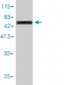 CTSD Antibody (monoclonal) (M01)