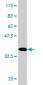DHFR Antibody (monoclonal) (M01)