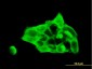 DSC3 Antibody (monoclonal) (M01)