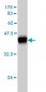 DSC3 Antibody (monoclonal) (M01)