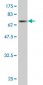 GPD2 Antibody (monoclonal) (M02)