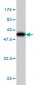 HLA-DRB4 Antibody (monoclonal) (M01)