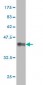 MAP2K5 Antibody (monoclonal) (M11)