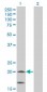 NDUFS4 Antibody (monoclonal) (M01)