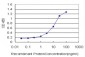 NSDHL Antibody (monoclonal) (M01)