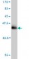 NSDHL Antibody (monoclonal) (M01)