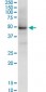 NSDHL Antibody (monoclonal) (M01)