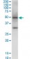 NSDHL Antibody (monoclonal) (M01)