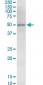 NSDHL Antibody (monoclonal) (M01)