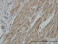 PDHB Antibody (monoclonal) (M03)