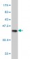 PDHB Antibody (monoclonal) (M03)