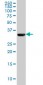 PDHB Antibody (monoclonal) (M03)