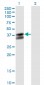 PDHB Antibody (monoclonal) (M03)