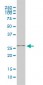 PGAM1 Antibody (monoclonal) (M01)