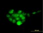 PSMD14 Antibody (monoclonal) (M01)