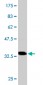 S100A7 Antibody (monoclonal) (M02)