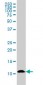 S100A7 Antibody (monoclonal) (M02)