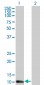 S100A7 Antibody (monoclonal) (M02)