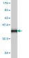 S100A7 Antibody (monoclonal) (M03)