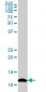 S100A7 Antibody (monoclonal) (M03)