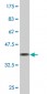 TMEFF2 Antibody (monoclonal) (M08)