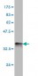 TNFRSF19 Antibody (monoclonal) (M01)