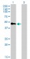 TNFRSF19 Antibody (monoclonal) (M01)