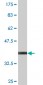 UBE2B Antibody (monoclonal) (M06)