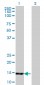 UBE2B Antibody (monoclonal) (M06)